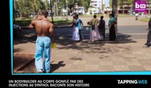 Un bodybuilder au corps gonflé par des injections au Synthol raconte son histoire (vidéo)