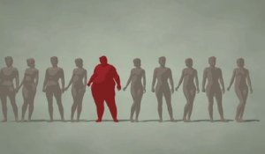 Obésité: Malte championne d'Europe, la Roumanie la moins touchée