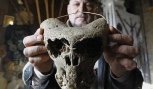Des crânes vraiment "bizarres" retrouvés en Russie