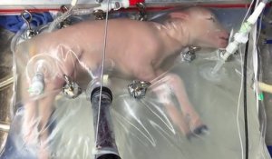 Des agneaux se développent dans un utérus artificiel