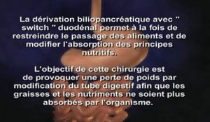 Dérivation biliopancréatique