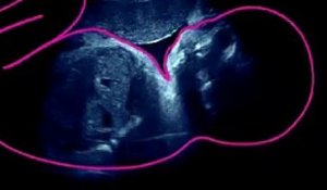 Voyage in utero - le 9e mois