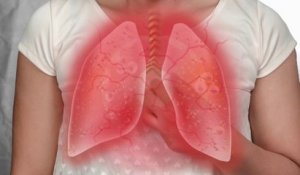 Santé - Mardi 7 mai : journée mondiale de l’asthme