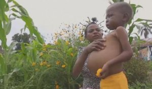 RDC : plus de 260 000 nenfants malnutris dans le Kasaï