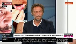 EXCLU - Agressé à coups de couteau, le gilet jaune Thierry-Paul Valette annonce qu'il va porter plainte aujourd'hui - VIDEO