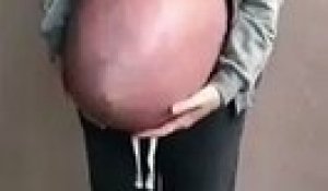 Regardez à quoi ressemble le ventre d'une femme enceinte de triplés