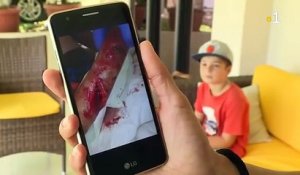 POLYNÉSIE - Un jeune héraultais de 9 ans, en vacances en Polynésie se fait mordre par un requin