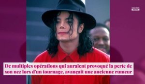 Michael Jackson : des révélations sur son nez dévoilées