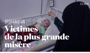 En Afghanistan, la faim conduit des bébés aux portes de la mort