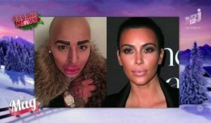 Le zapping du 19/12 : Il dépense 190.000 euros pour ressembler à Kim Kardashian