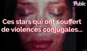 Vidéo : Ces stars qui ont souffert de violences conjugales…