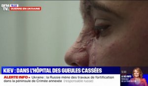 "C'est dur de voir mon visage comme ça": des Ukrainiens défigurés par les frappes russes témoignent