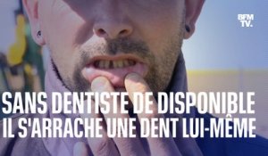 Charente-Maritime: faute de dentiste disponible, il s'arrache une dent lui-même
