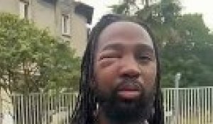 Youssouf Traoré, 29 ans, frère d'Adama, apparaît l'œil droit tuméfié et la manche du t-shirt déchirée ans une vidéo