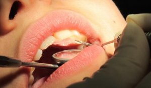 VIH : 1145 patients invités à se faire dépister à cause d'un dentiste de Cherbourg