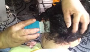 Un enfant a les cheveux infestés de poux