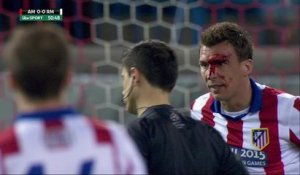 Mario Mandzukic le visage en sang après un coup de coude de Sergio Ramos