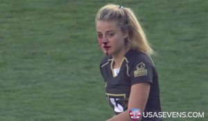 Rugby à 7 : Gerogia Page se casse le nez, se relève et plaque deux adversaires