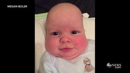 Un Enfant Nait Avec La Tete Deformee Doit Porter Un Casque Pour Retrouver Une Forme Normale Sur Orange Videos