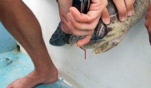 Il enlève une paille de la narine d'une Tortue de Mer au Costa Rica