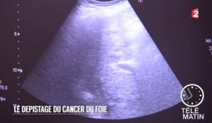 Santé - Le dépistage du cancer du foie - 2015/09/31