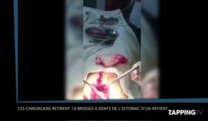 Ces chirurgiens retirent 18 brosses à dents de l’estomac d’un patient, la vidéo choc !