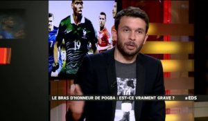 Foot - E21 - EDS : Le bras d'honneur de Pogba. Est-ce grave ?