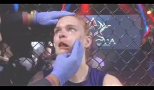 Une combattante MMA finit avec une tête "comme ça"...