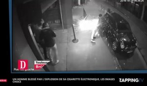 Un homme brûlé par l’explosion de sa cigarette électronique, les images chocs