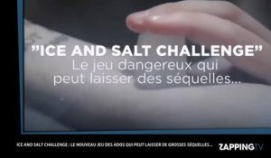 Le "ice and salt challenge", le nouveau jeu très dangereux des adolescents (Vidéo)