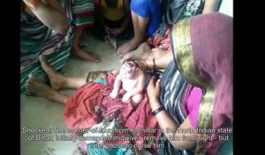 Né avec une maladie génétique très rare, ce bébé est vénéré en Inde