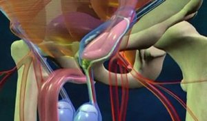 La hernie inguinale expliquée en vidéo
