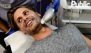 Exclu Vidéo : Benoît Dubois : "Mon lifting ? C’est pour réparer ma peau acnéique !"