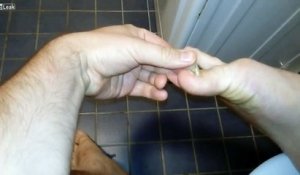 Le Moment Douloureux Où Elle Se Retire Un Ongle Qui Sest