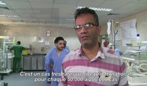 Appel pour une opération à l'étranger de siamoises nées à Gaza