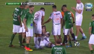 Rescapé du crash de Chapecoense, il simule une crampe... à sa prothèse !