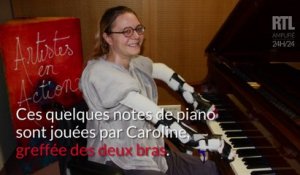 Greffée des deux bras, Caroline peut de nouveau jouer du piano