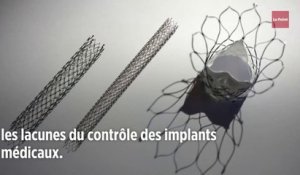 Les « Implant Files », nouveau scandale sanitaire ?