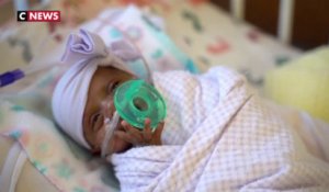 Pesant 245 grammes, le plus petit bébé du monde né vivant, a quitté l'hôpital