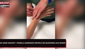 Adil Rami violent ? Pamela Anderson dévoile ses blessures aux mains (Vidéo)
