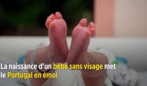 Portugal : la naissance d'un bébé sans visage met le pays en émoi