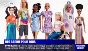 Sans cheveux ou atteinte de Vitiligo... Mattel dévoile ses nouvelles Barbie pour plus de diversité