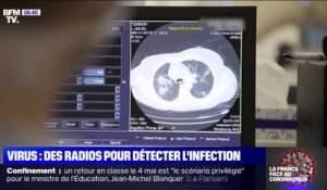 Coronavirus: des radios du thorax permettent de détecter l'infection dans un hôpital à Strasbourg