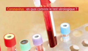 Coronavirus : en quoi consiste le test sérologique ?