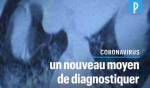 Un scanner pour détecter le coronavirus chez des personnes aux «tests négatifs»