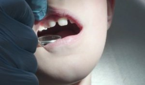 "Bébés Coca": quel est ce phénomène qui inquiète les dentistes ?