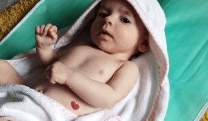 Né à quelques jours de la Saint-Valentin, ce bébé possède une tache de naissance en forme de cœur sur le ventre