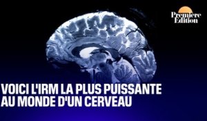 Voici l'IRM la plus précise au monde d'un cerveau (et elle est française)
