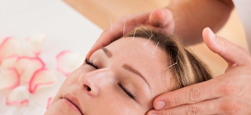 Acupuncture : quelles précautions adopter après une séance ?